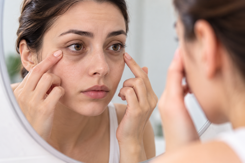 Cómo identificar ojeras y líneas de expresión en el contorno de ojos. Mujer observando sus ojeras y líneas de expresión alrededor de los ojos frente al espejo.